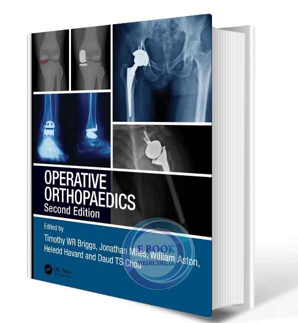 دانلود کتاب Operative Orthopaedics 2nd  2021 (ORIGINAL PDF)